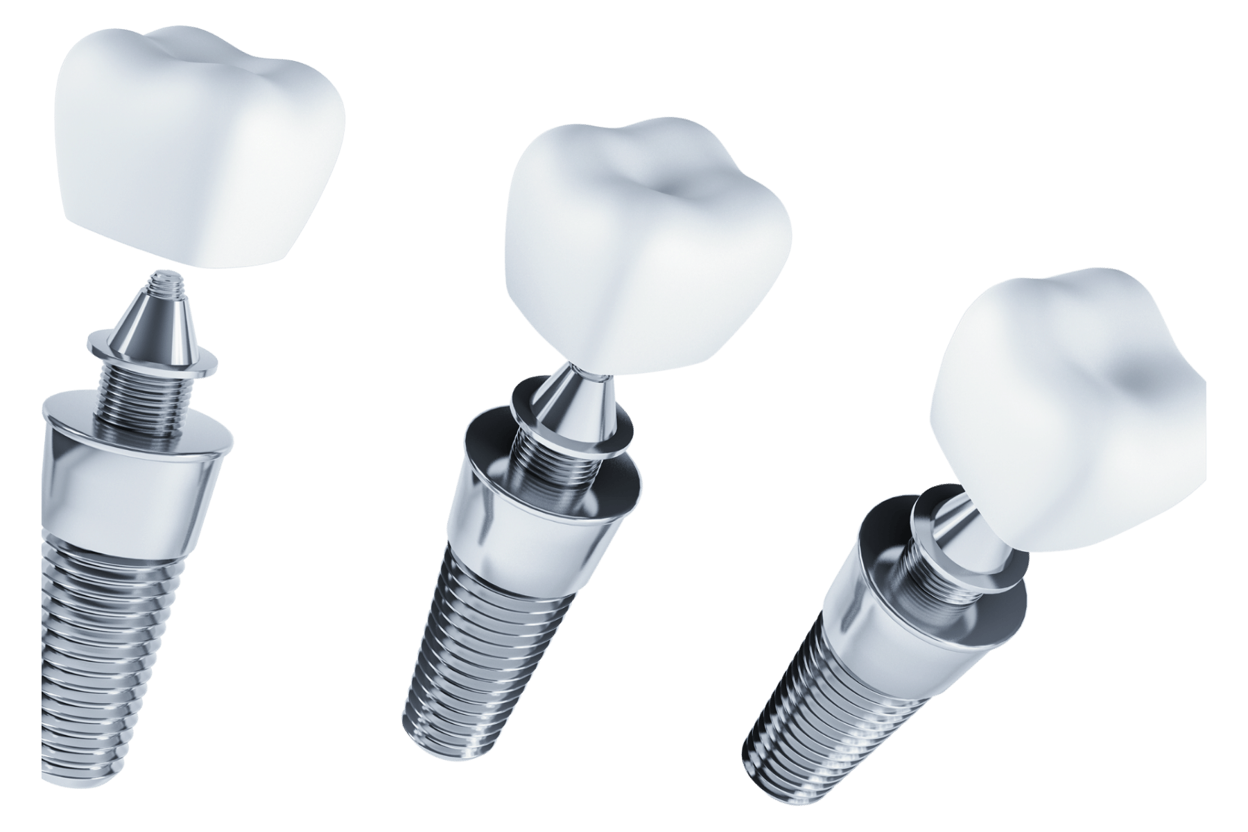 implant ay ışığı diş