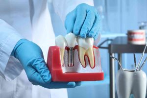 implant tedavisi ay ışığı diş